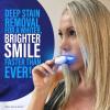 imageGuruNanda Professional Teeth Whitening Wireless Kit with LED Light ampamp Whitening Pen Helps Remove Surface Stains from Coffee Food Soda 40 Treatments